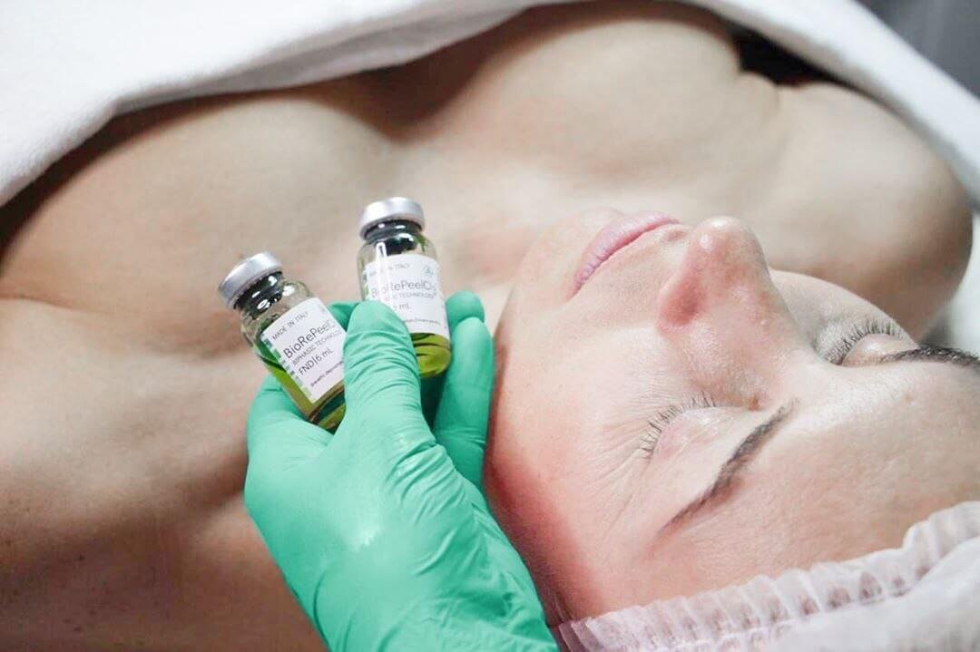 Обов’язкова умова краси вашої шкіри — пілінги у BEAUTY STORY